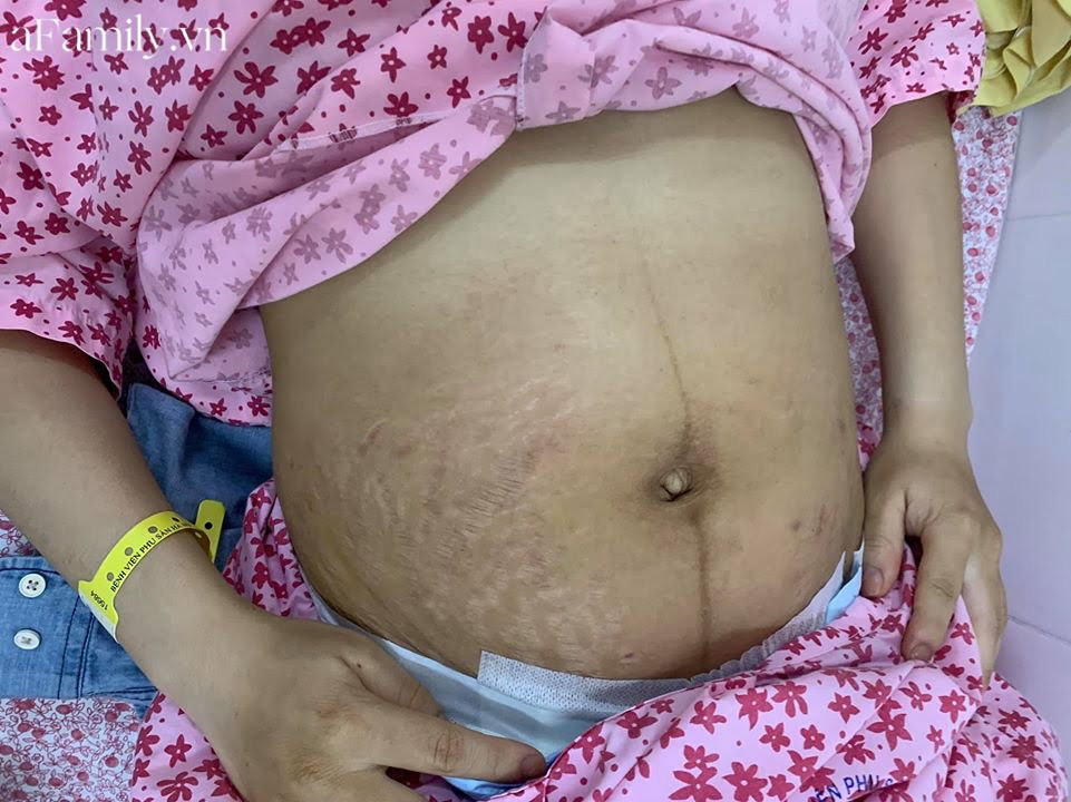 Chăm sóc da mặt sau sinh – phục hồi tuổi xuân