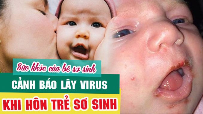 Khi hôn trẻ, có thể bạn sẽ lan truyền những loại virus, vi khuẩn gì?