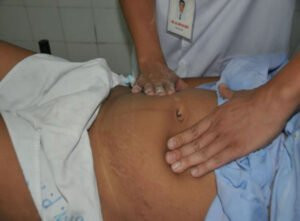 Cẩm nang chăm sóc mẹ và bé sau sinh tại nhà