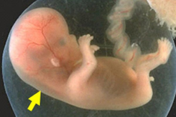 Thời điểm quan trọng để đo độ mờ da gáy